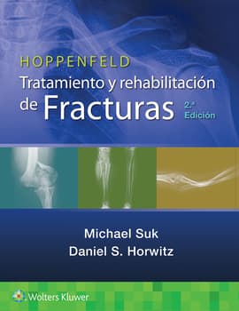 SUK- HOPPENFELD. TRATAMIENTO Y REHABILITACION DE FRACTURAS, 2.¦Ed. 2022