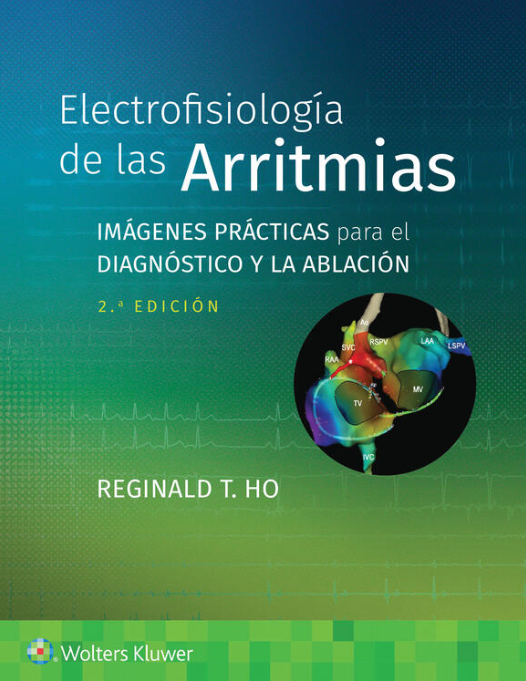 HO- ELECTROFISIOLOGIA DE LAS ARRITMIAS. IMAGENES PRACTICAS PARA EL DIAGNOSTICO Y LA ABLACION, 2.¦Ed. 2023