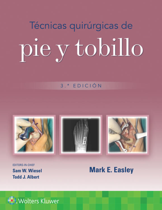 EASLEY- TECNICAS QUIRURGICAS DE PIE Y TOBILLO, 3.¦Ed. 2024