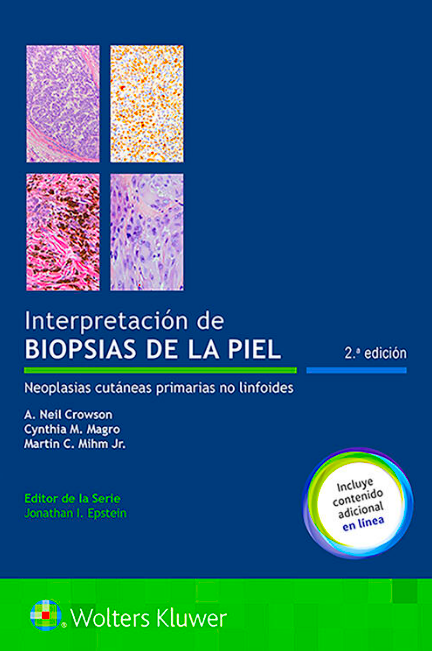 CROWSON- INTERPRETACION DE BIOPSIA DE LA PIEL, 2.¦  Ed.  2020