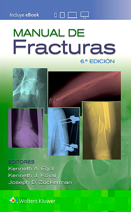 EGOL- MANUAL DE FRACTURAS, 6.¦  Ed.  2020
