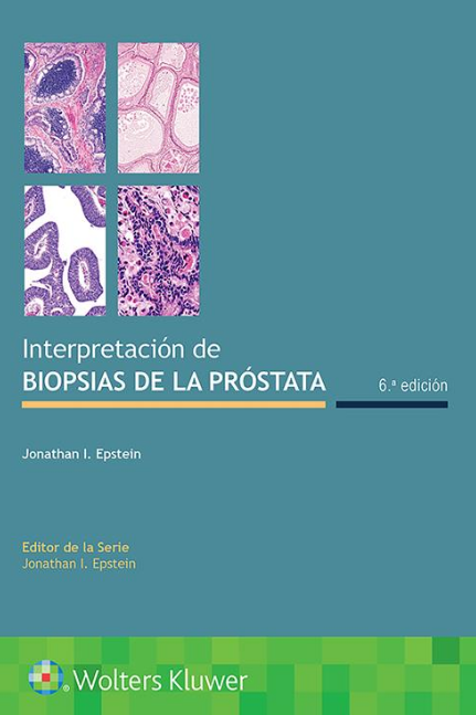EPSTEIN- INTERPRETACION DE BIOPSIAS DE LA PROSTATA, 6.¦  Ed.  2021