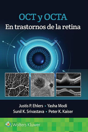 EHLERS- OCT Y ANGIOGRAFIA DE  OCT EN TRASTORNOS DE LA RETINA, 1.¦Ed.  2021