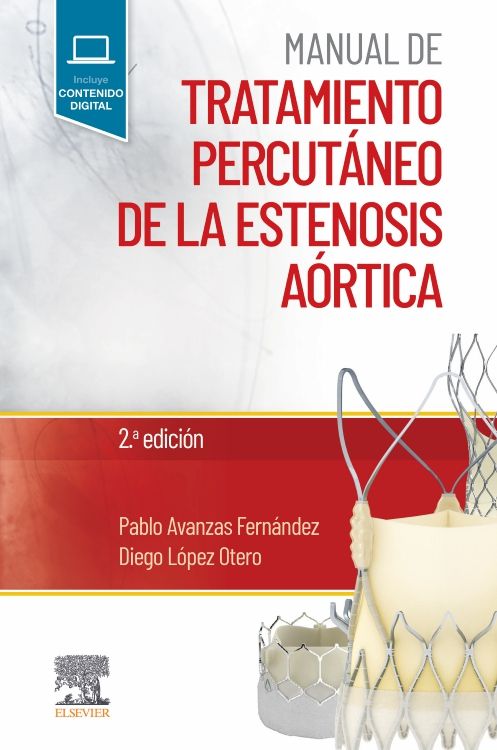 AVANZAS FERNANDEZ, P.- MANUAL DE TRATAMIENTO PERCUTANEO DE LA ESTENOSIS AORTICA, 2Ed., 2022